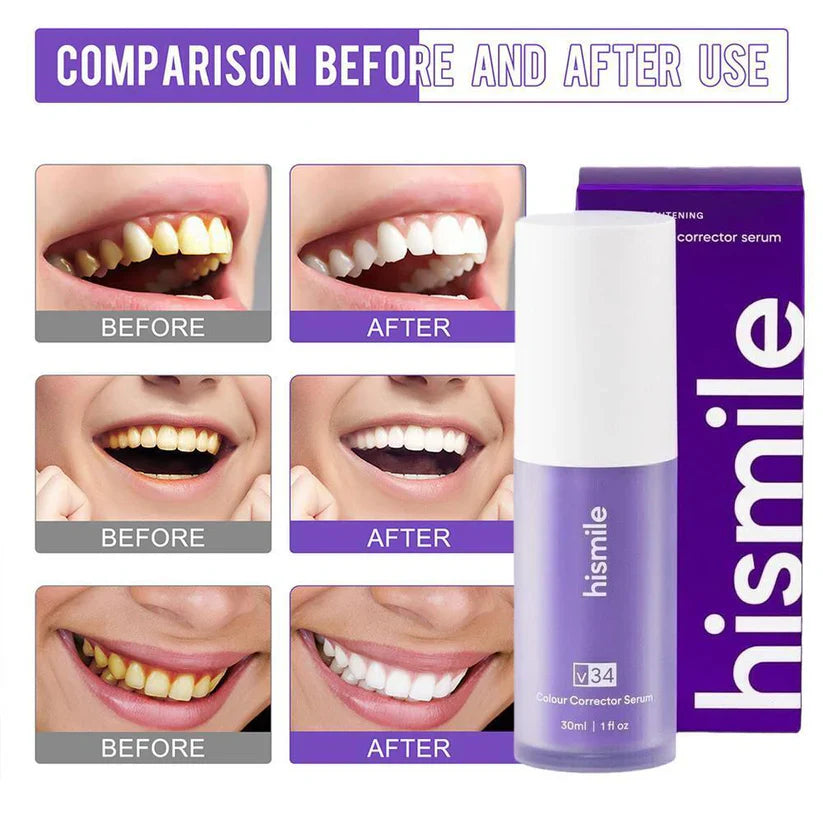 hismile v34 colour corrector serum